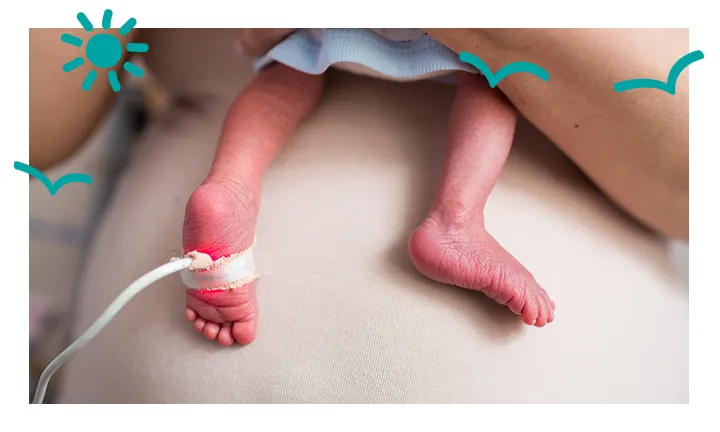 BABY LEGS WITH MONITOR ATTACHED TO LEFT FOOT