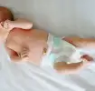 A newborn with an outie belly button