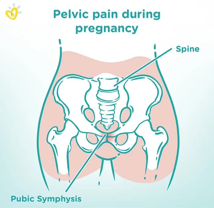 3 Ways to Decrease Pubic Symphysis Pain During Pregnancy — Heppe  Chiropractic
