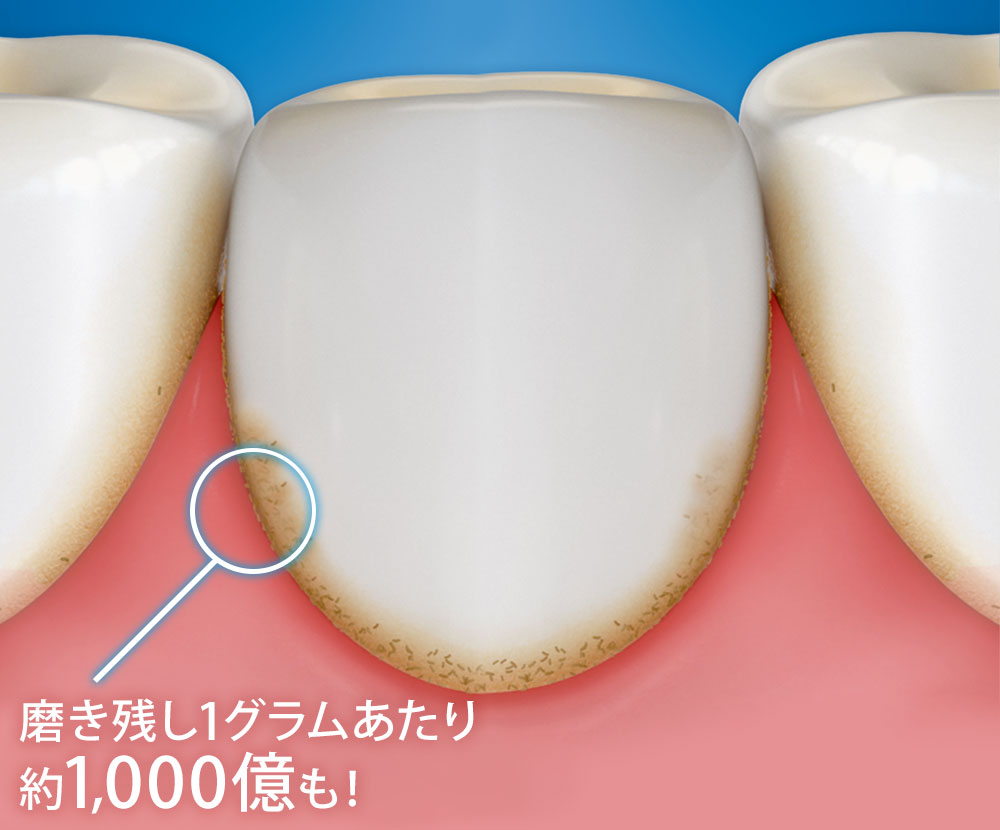 歯茎が下がる！！ 歯肉退縮の原因と対策 ｜歯周病【ブラウンオーラルB】