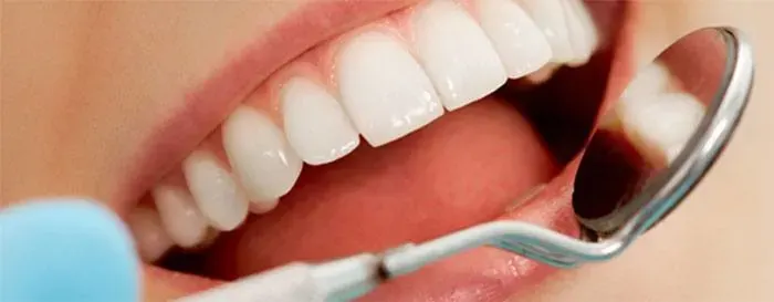 歯周病の進行段階 