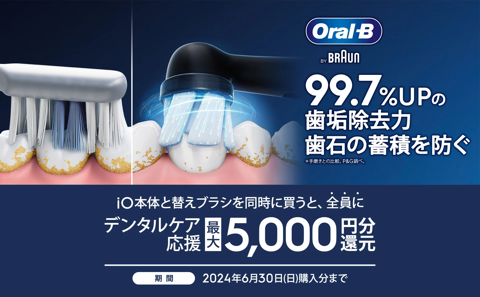 iO本体と替えブラシを同時に買うと、全員にデンタルケア応援最大5,000 