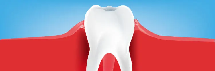 【白い・赤い】歯ぐきが腫れる原因と対策 