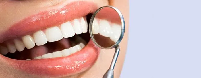 歯の黄ばみを除去する 
