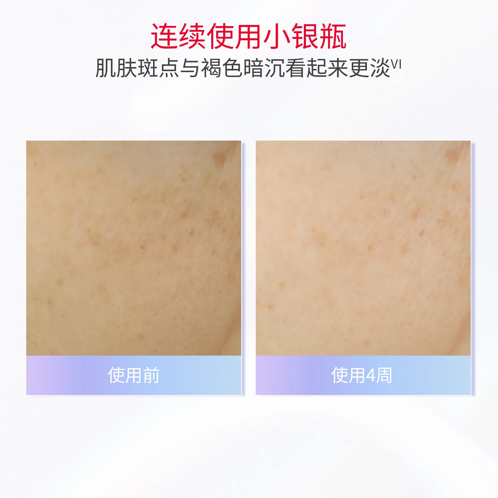 GASE - Product Overview - Image 05