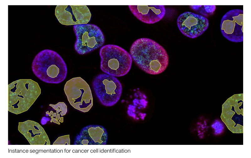 A view of cells through a microscope. Portions of each cell are outlined and highlighted in yellow. The caption of the image reads: "Instance segmentation for cancer cell identification."