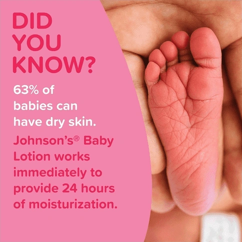 Text stating 'DID YOU KNOW? 63% of babies can have dry skin. Johnson’s Baby Lotion works immediately to provide 24 hours of moisturization' with a close-up of a baby’s foot.