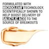 MicroClear® Technology boosts delivery of Salicylic Acid to the source of breakouts