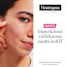 3574661889085 NTG PIMPLE PATCHES B+ DEF SI 01