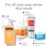 Regimen for all your acne-prone skin needs. Clean with Acne Wash, Treat with Treatment Pads, Clear with Acne Spot Gel, and Moisturize with Water Gel