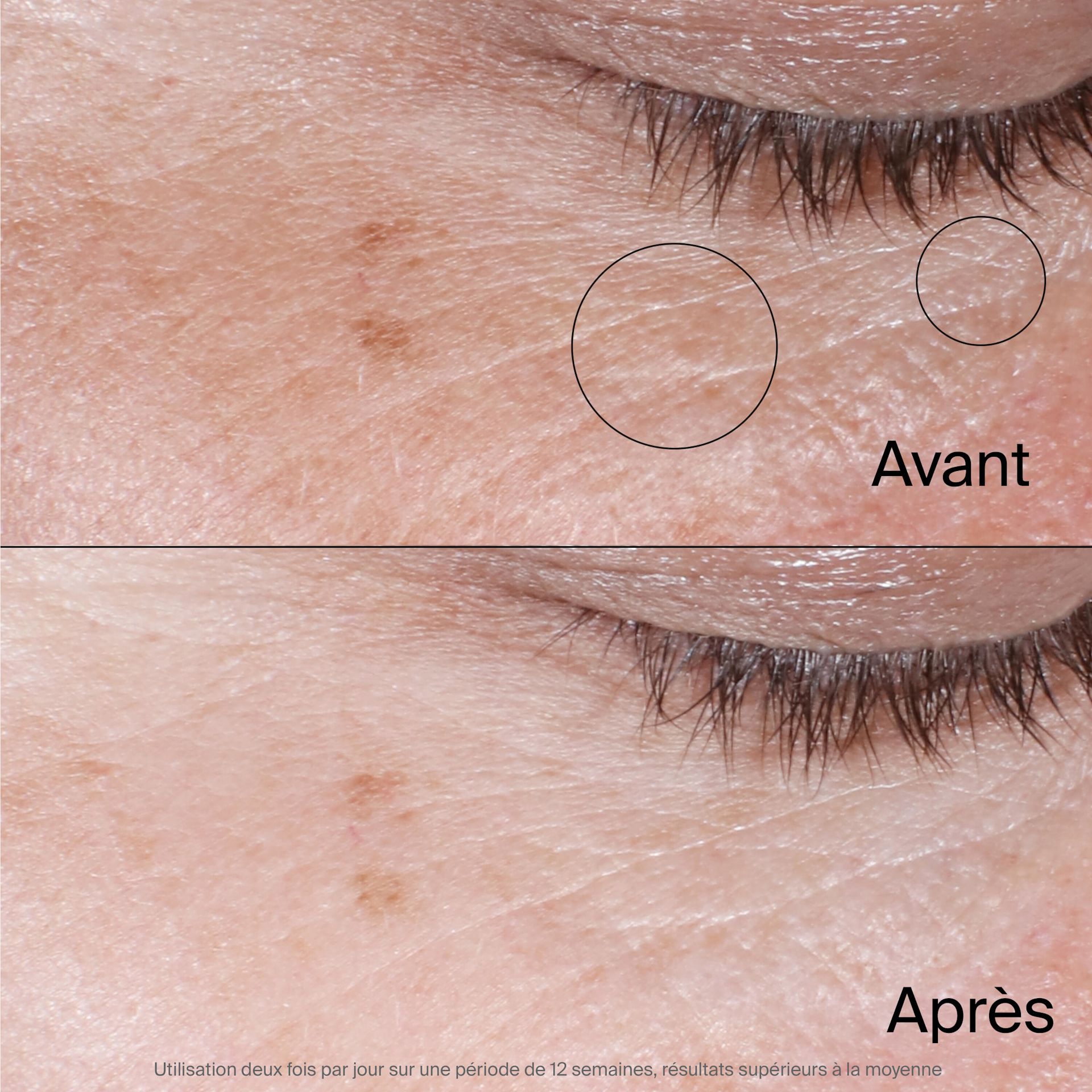 NA CA NTG CollagenBank EyeCream ATF6 BeforeAfter Amazon 3000x3000FR JPG