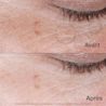 NA CA NTG CollagenBank EyeCream ATF6 BeforeAfter Amazon 3000x3000FR JPG