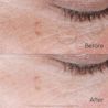 NA CA NTG CollagenBank EyeCream ATF6 BeforeAfter Amazon 3000x3000EN JPG