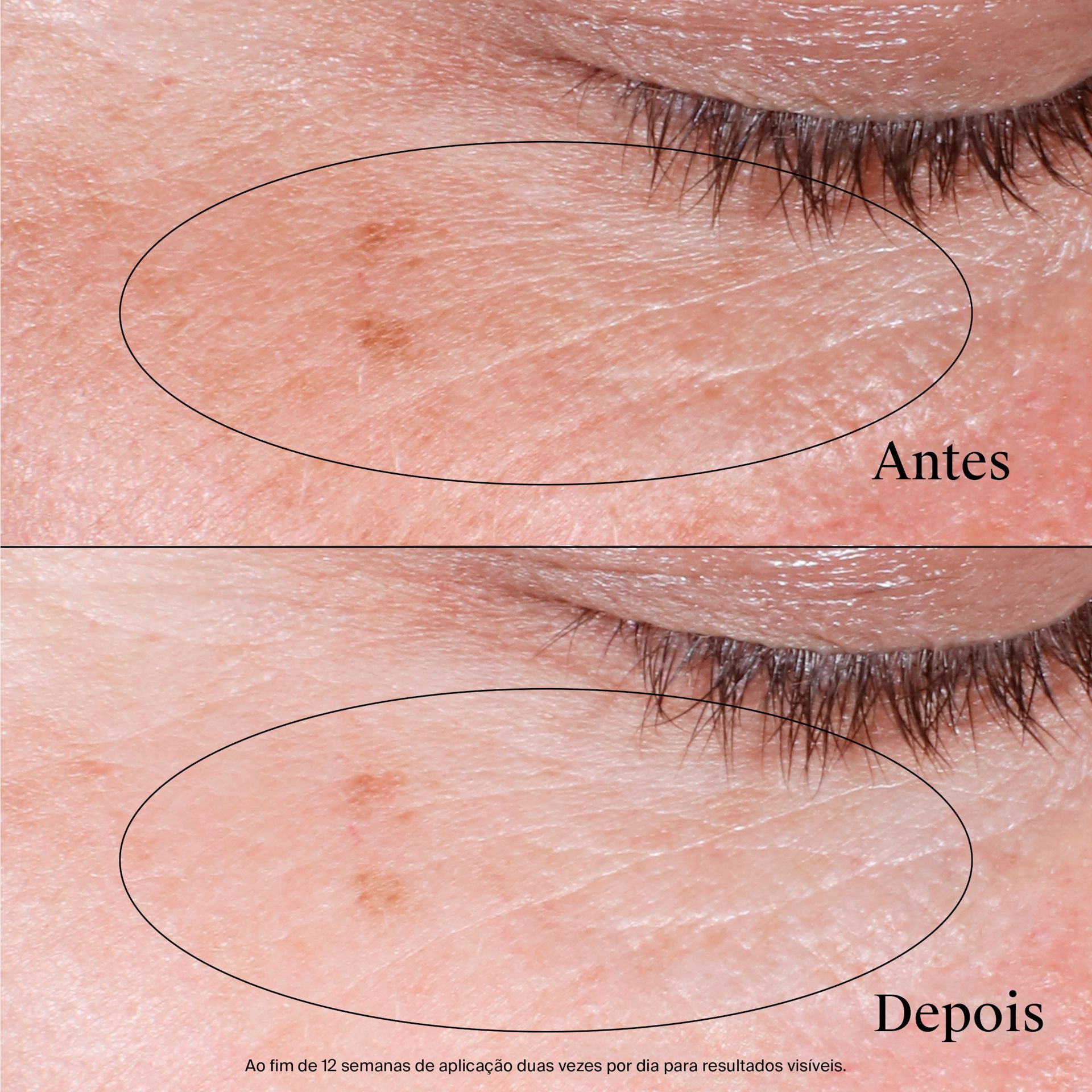 NA US NTG CollagenBank EyeGelCream ATF6 Amazon 3000x3000