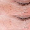 NA US NTG CollagenBank EyeGelCream ATF6 Amazon 3000x3000