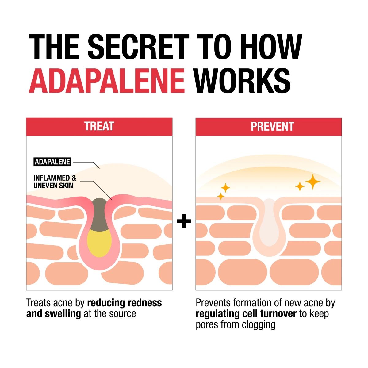 NTG_Adapalene_EDI_3_STS_Text.webp