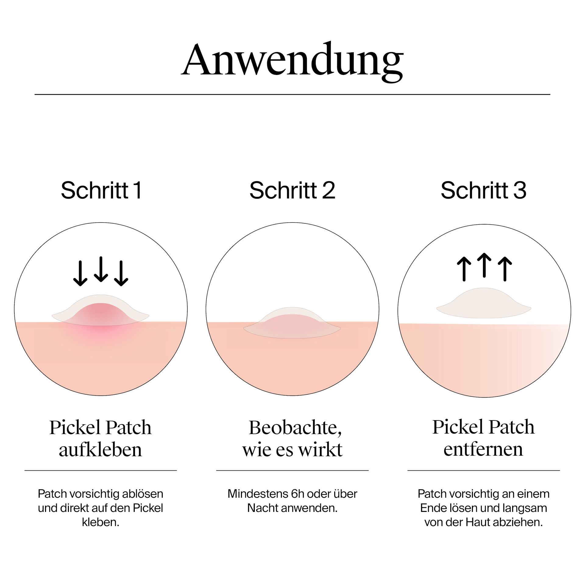Wie ich die Pickel Patches anwenden kann