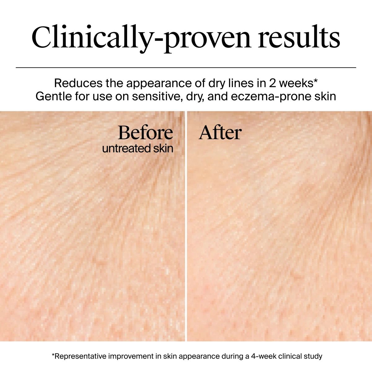 NA_US_NTG_HydroBoost_GelCream_1.7floz_BeforeAndAfter_ATF3_Amazon_3000x3000.webp