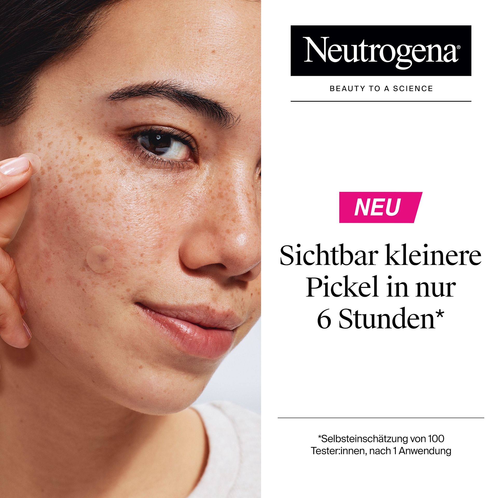 Sichtbar kleinere Pickel in nur 6 Stunden