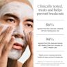 NA-US-NTG-Acne-CleansingMask-ClinicallyFocused-ATF6-Amazon-3000x3000.webp