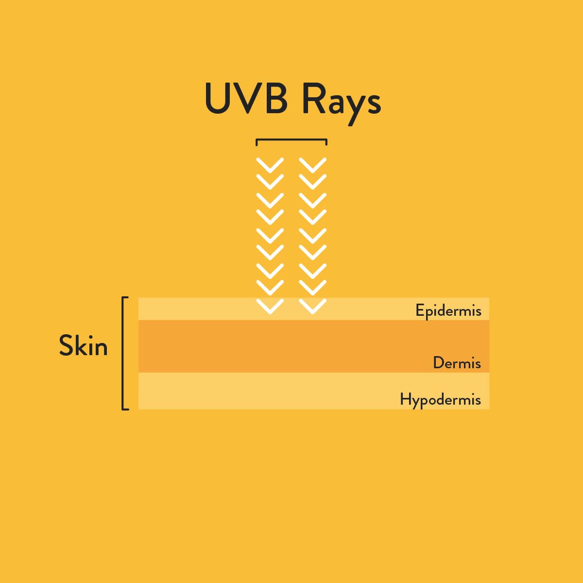 UVB