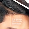 T/Gel® Champú Anticaspa Cabello Graso