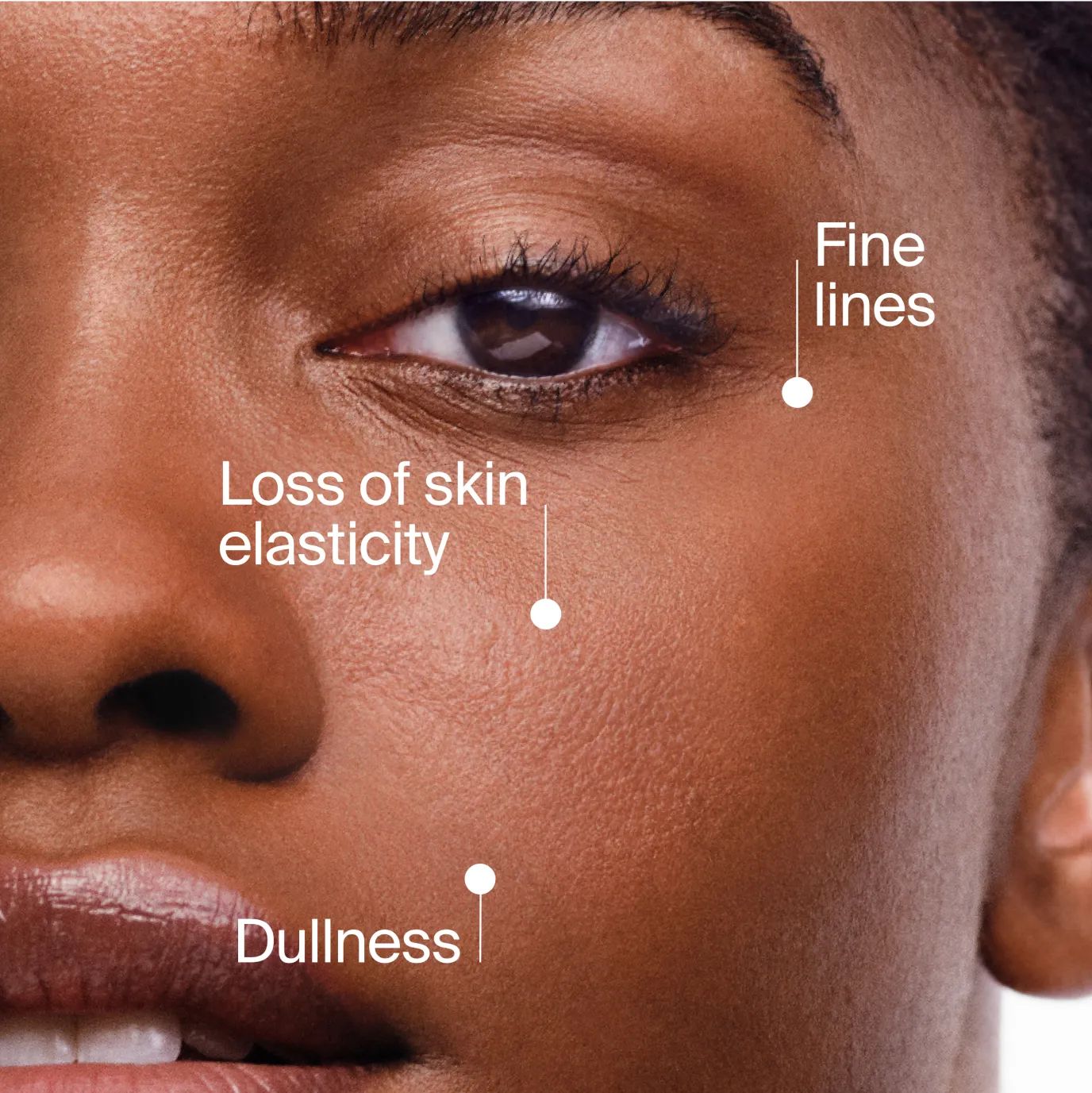 You lose up to 1% of collagen each year.