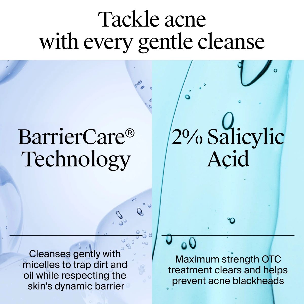NA_US_NTG_AcneLegacy_OFAW_FF_9.1oz_ATF4_Ingredients_Amazon_3000x3000.webp