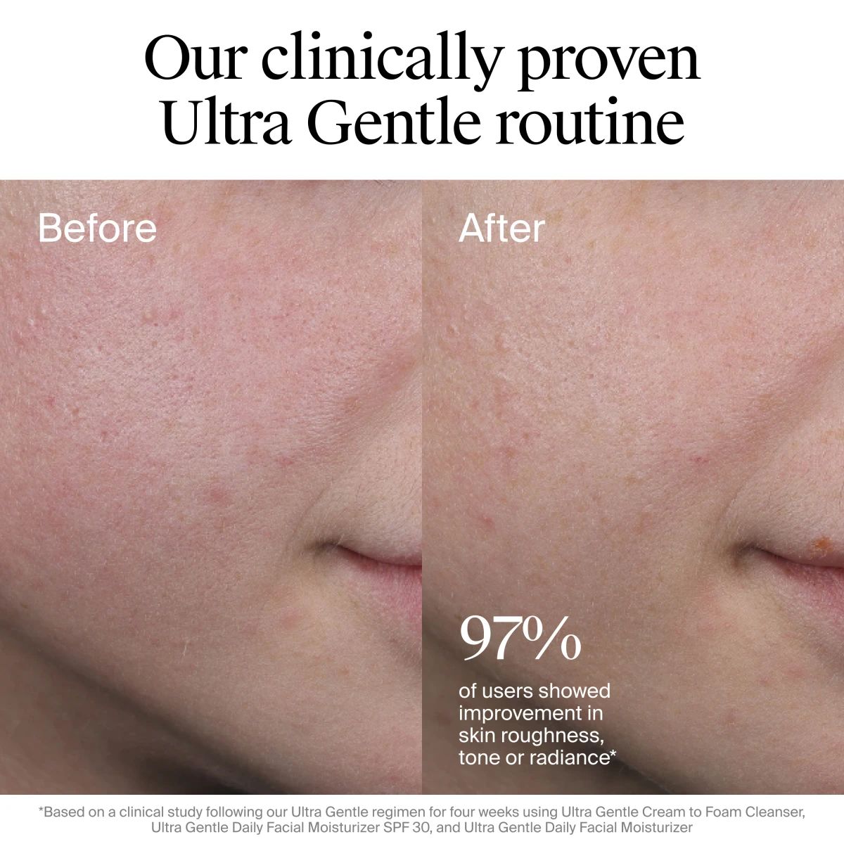 Before-and-after cheek close-ups show smoother skin; 97% saw improved tone, radiance, or texture