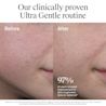 Before-and-after cheek close-ups show smoother skin; 97% saw improved tone, radiance, or texture