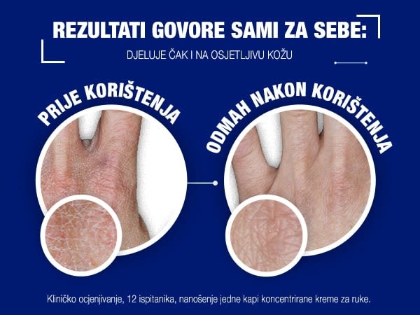 Neutrogena® Norwegian Formula® koncentrirana krema za ruke s mirisom - Image 2 - Neutrogena - hr-HR