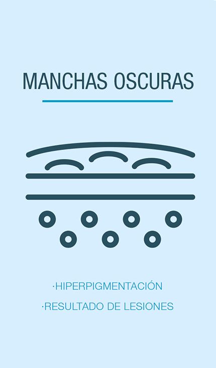manchas_oscuras