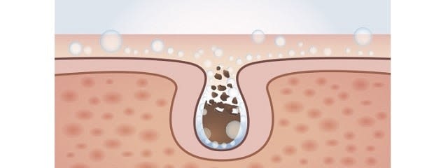 neutrogena-microclear1