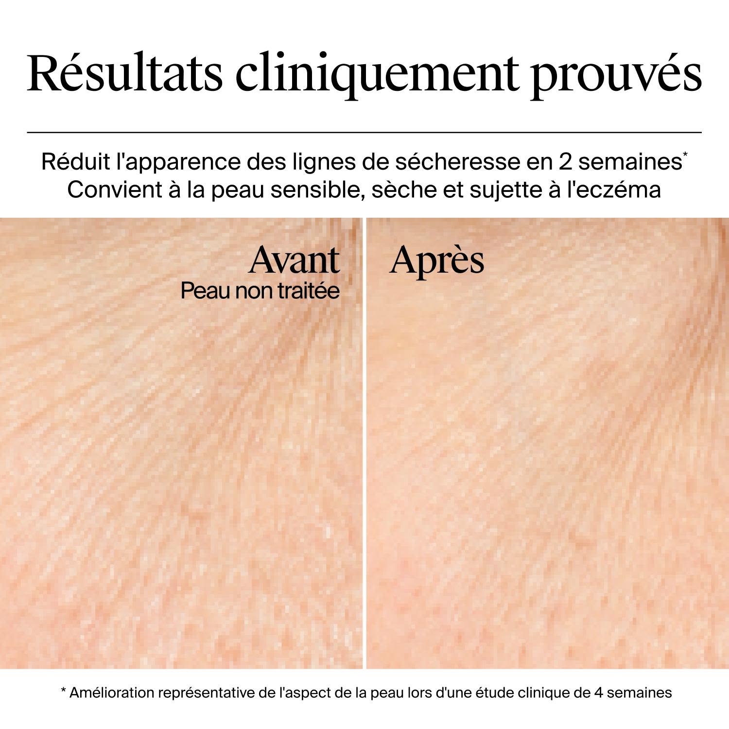 Résultats avant et après utilisation du gel-crème Hydro Boost de Neutrogena (sans parfum), après une étude clinique de 4 semaines
