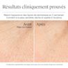 Résultats avant et après utilisation du gel-crème Hydro Boost de Neutrogena (sans parfum), après une étude clinique de 4 semaines
