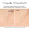 Résultats avant et après utilisation du gel-crème Hydro Boost de Neutrogena (sans parfum), après une étude clinique de 4 semaines