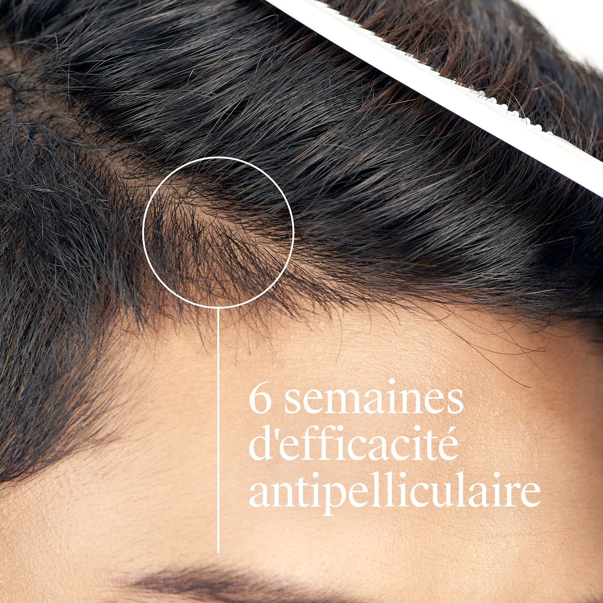 NTG EMEA FR 3574661450599 3574661450704 NG T GEL A D N-DRY OILY HAIR 250 SI03 THUMB (1)