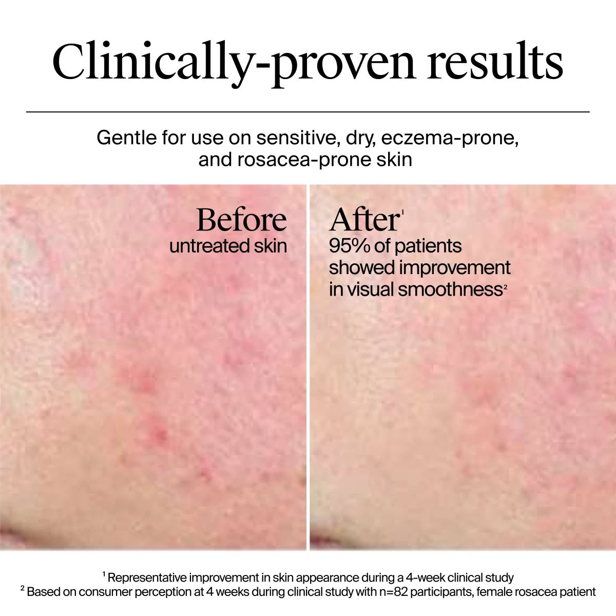 NA_US_NTG_HydroBoost_WaterCream_1.7floz_BeforeAndAfter_ATF3_Amazon_3000x3000.webp