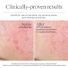 NA_US_NTG_HydroBoost_WaterCream_1.7floz_BeforeAndAfter_ATF3_Amazon_3000x3000.webp