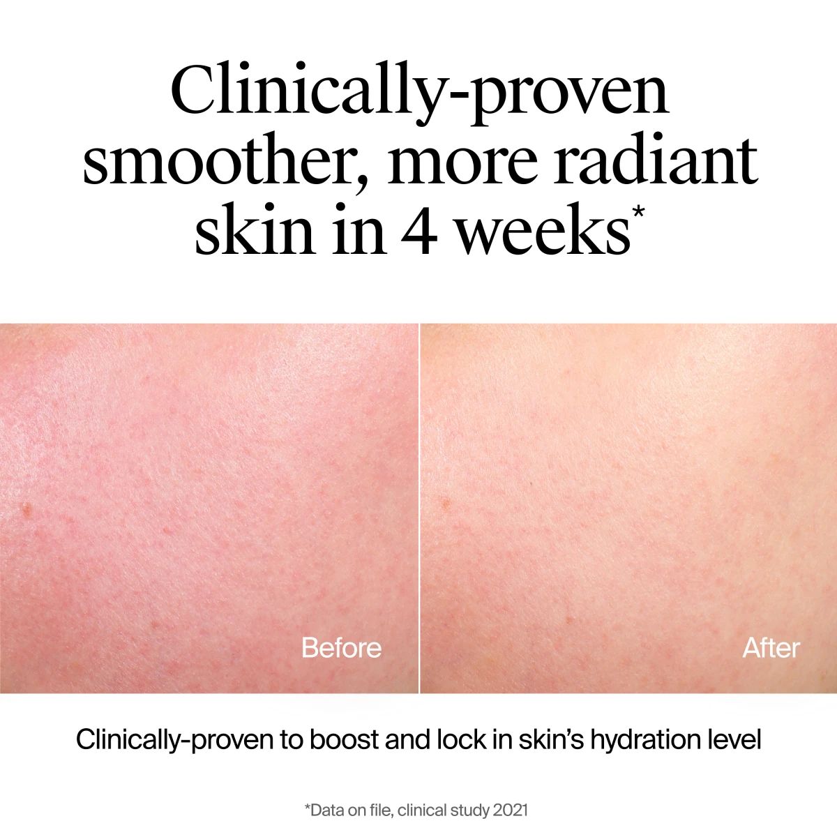 Before and after skin comparison showing clinically proven smoother, radiant, hydrated results