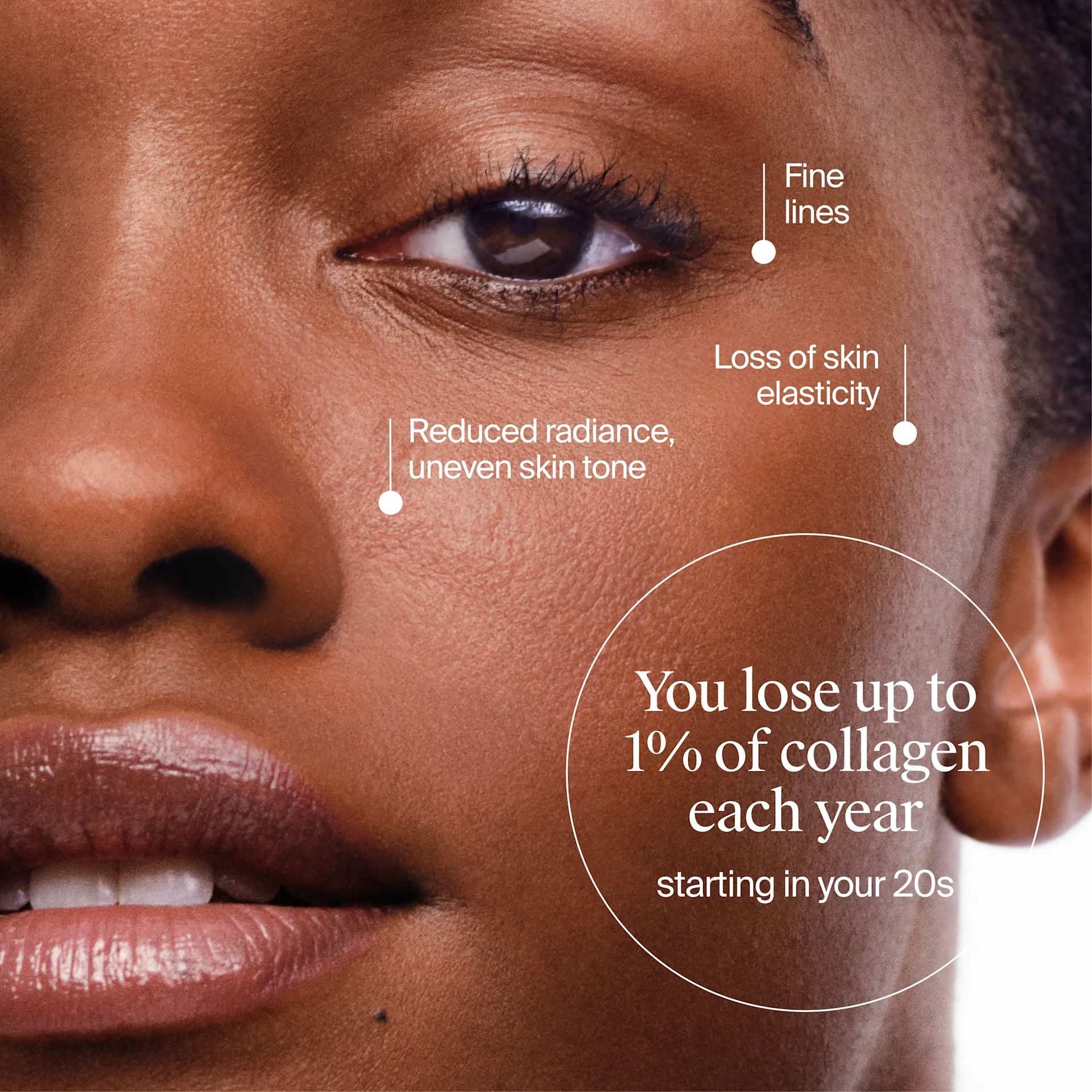 You lose up to 1% of collagen each year starting in your 20s. 
