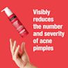 NEUTROGENA® Stubborn Texture Daily Cleanser, pump bottle, 186 mL with a text ‘Visibly reduces the number and severity of acne pimples'