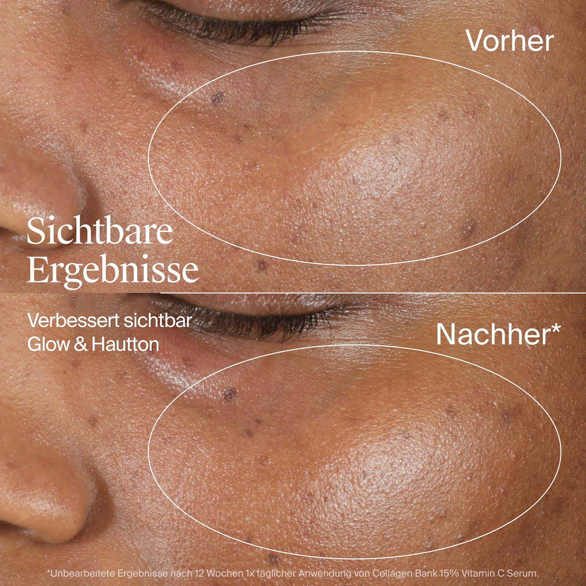Sichtbare Ergebniss – verbessert sichtbar Glow & Hautton