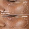 Sichtbare Ergebniss – verbessert sichtbar Glow & Hautton