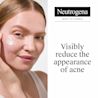 Visibly reduce the appearance of acne with Neutrogena® Rapid Clear Stubborn Acne Spot Gel