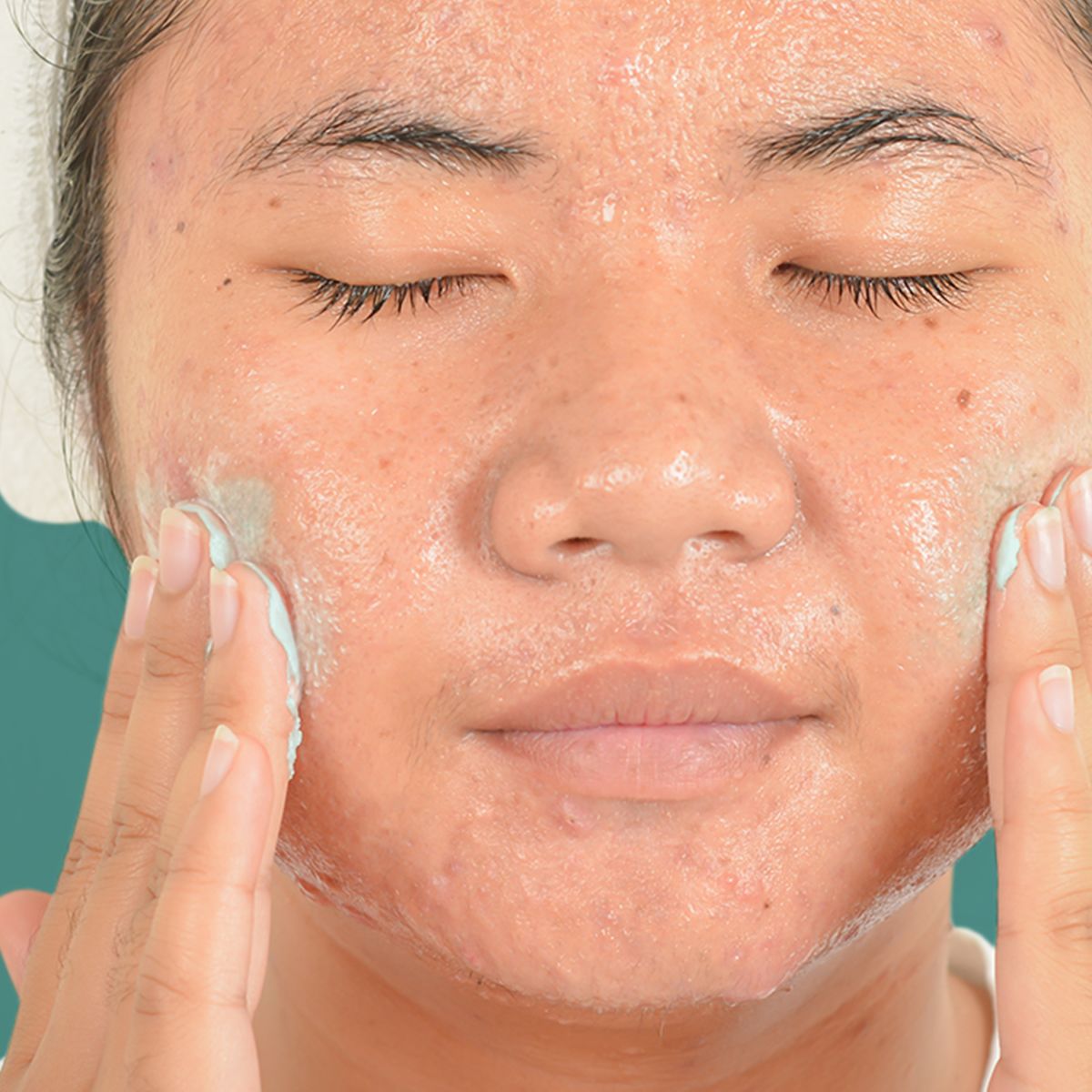 NTG_Acne_Stress_Control_Power_Scrub_13_APPL.webp