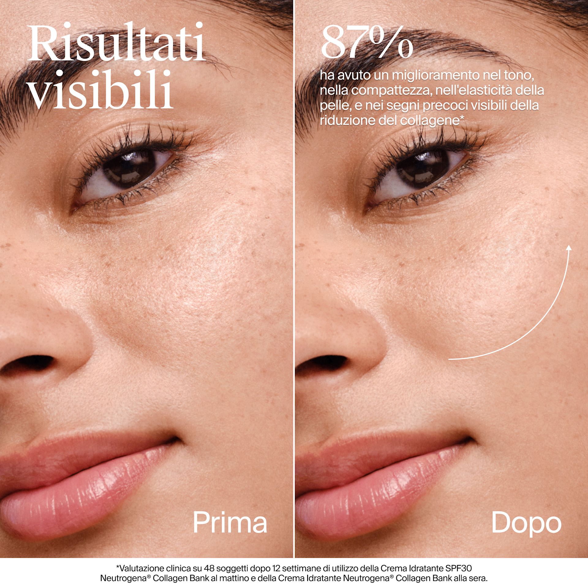 90669700 B+ NG COLLAGEN BANK SPF DEF SI 03
