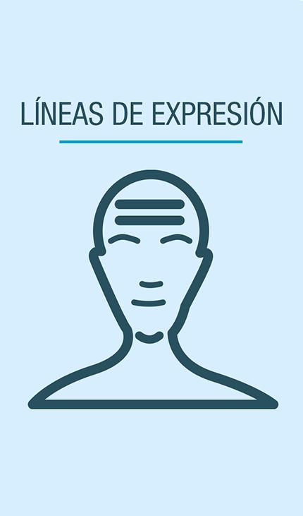lineas_expersion