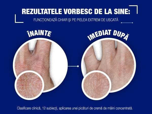Neutrogena® Formulă Norvegiană® Cremă de Mâini Concentrată Fără Parfum - Image 2 - Neutrogena - ro-RO