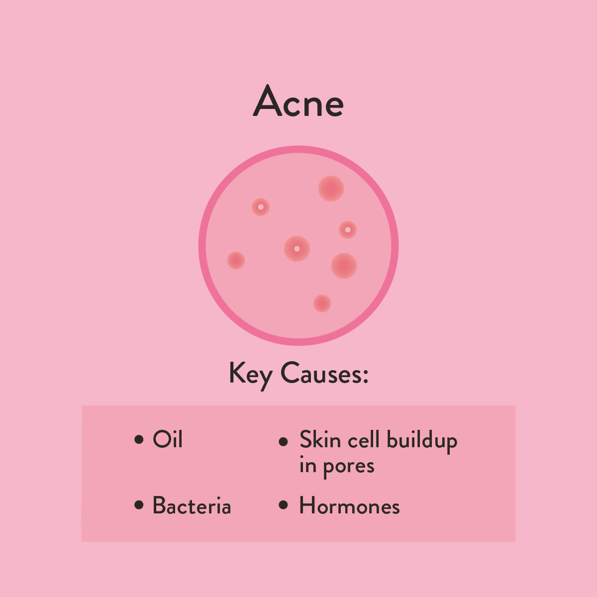 Acne